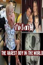Watch Aidan The Rarest Boy In The World Gomovies