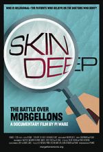 Watch Skin Deep: The Battle Over Morgellons Gomovies