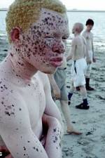 Watch Albino United Gomovies