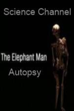 Watch Science Channel Elephant Man Autopsy Gomovies