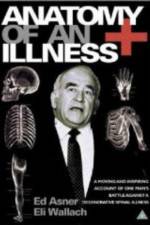 Watch Anatomy of an Illness Gomovies