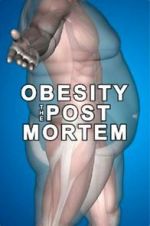Watch Obesity: The Post Mortem Gomovies