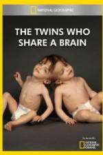 Watch National Geographic The Twins Who Share A Brain Gomovies