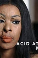 Watch Acid Attack: My Story Gomovies