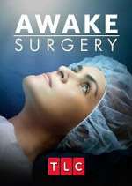 Watch Awake Surgery Gomovies