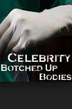 Watch Celebrity Botched Up Bodies Gomovies